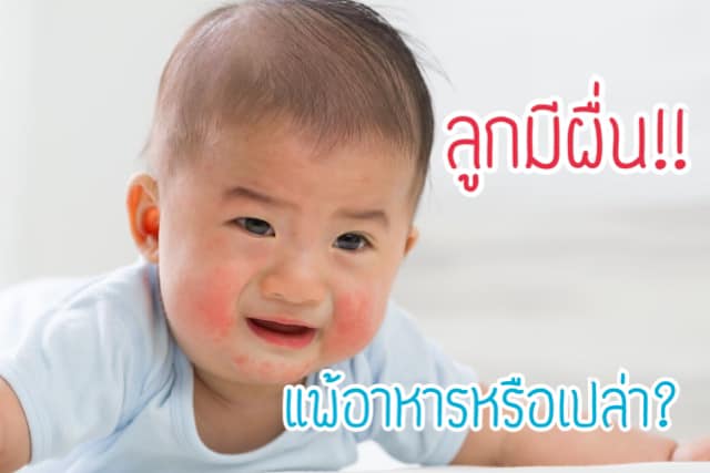 อาการ ผื่นขึ้น ของลูกเกิดจากอะไรได้บ้าง